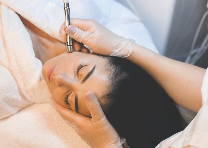 Microdermabrasion treatment